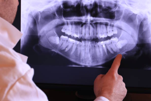 Best After-Hours Emergency Dentist in Cabot, AR